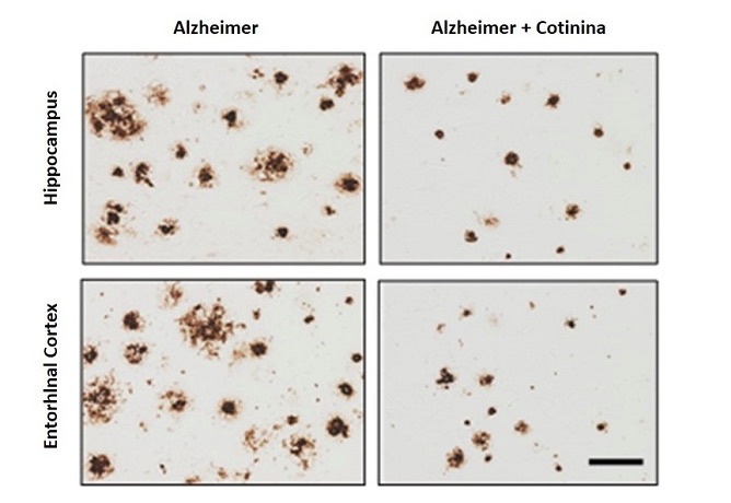 Cotinina Alzheimer